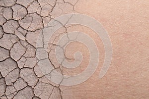 dry woman skin texture with dry soil