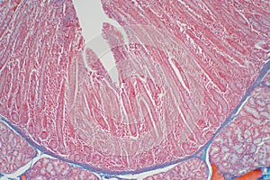 Duodenum biopsy from the pathology of  small intestine