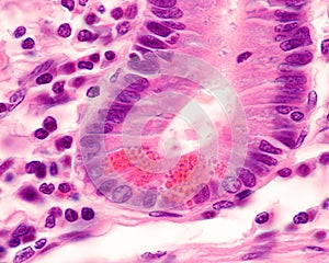 Duodenum. Paneth cells photo