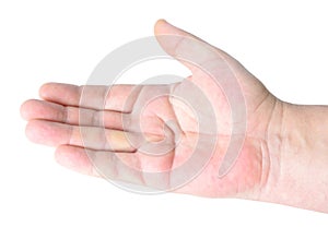 Dupuytren`s contracture, also called Dupuytren`s disease, Morbus Dupuytren, Viking disease, and Celtic hand. On white background photo