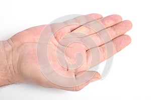 Dupuytren`s contracture, also called Dupuytren`s disease, Morbus Dupuytren, Viking disease, and Celtic hand. On white background photo