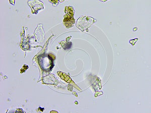 Dust and microorganisms microscopic view
