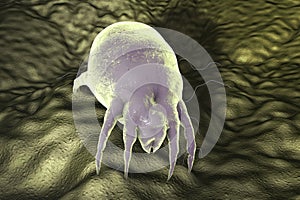 Dust mite Dermatophagoides