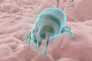 Dust mite Dermatophagoides