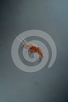 Dust mites under the microscope