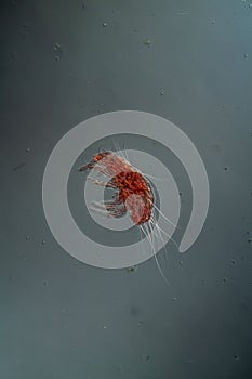 Dust mites under the microscope