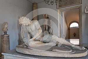 Dying Gaul