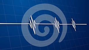 3D Perspective EKG Heart Rate Monitor Display