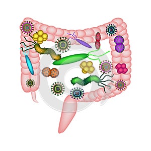 Dysbacteriosis of the intestine. Colon. dysbiosis of colon. Bacteria, fungi, viruses. Infographics.