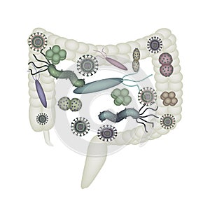 Dysbacteriosis of the intestine. Colon. dysbiosis of colon. Bacteria, fungi, viruses. Infographics. photo