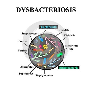 Dysbacteriosis of the intestine. Lactobacillus, Bifidobacteria, Streptococcus, Staphylococcus, E. coli, Aspergyllus mushrooms