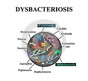 Dysbacteriosis of the intestine. Lactobacillus, Bifidobacteria, Streptococcus, Staphylococcus, E. coli, Aspergyllus mushrooms photo