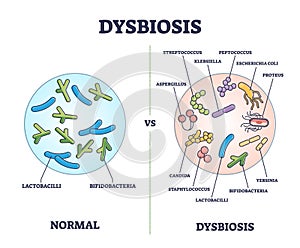 Dysbiosis versus normal gut or tract microflora with bacteria outline diagram photo