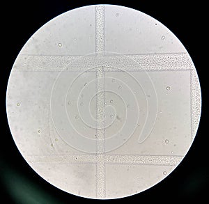 Dysmorphic urinary RBCs have been regarded as an indicator of glomerular pathology