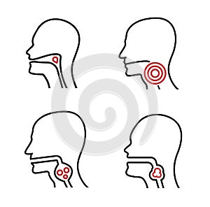 Dysphagia linear icon. Aphagia line pictogram. Difficulty in swallowing symbol.