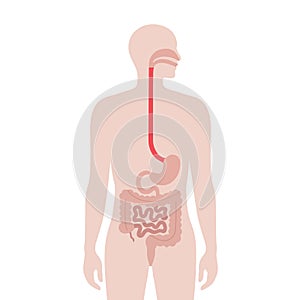 Dysphagia medical poster