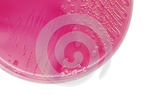 E.coli bacterial colonies on MacConkey agar plate