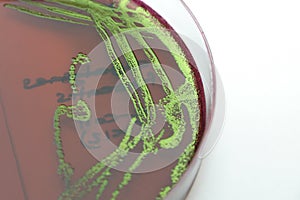 E. coli on EMB agar photo