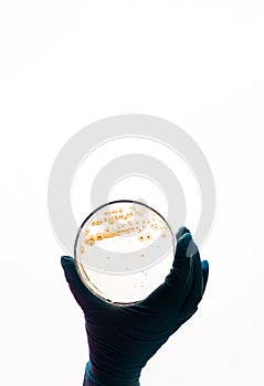 E.coli Escherichia bacteria in Petri dish photo