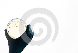 E.coli Escherichia bacteria on yellow agar in Petri dish