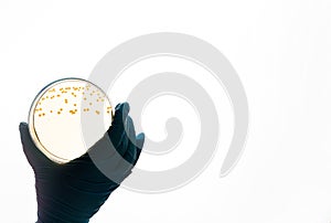 E.coli Escherichia bacteria on yellow agar in Petri dish photo