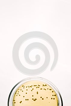 E.coli Escherichia bacteria on yellow agar plate