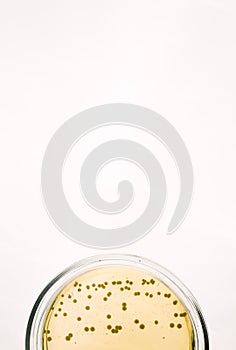 E.coli Escherichia bacteria on yellow agar plate photo