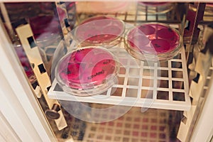 E. coli growing on a peri plate. Collected from a lettuce sample.