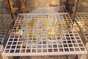 E. coli growing on a peri plate. Collected from a lettuce sample.