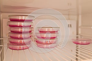 E. coli growing on a peri plate. Collected from a lettuce sample.