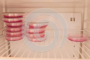 E. coli growing on a peri plate. Collected from a lettuce sample.