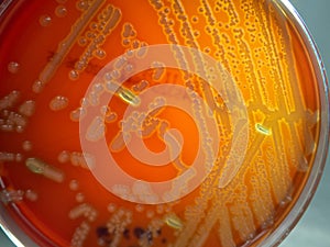 E. coli With Hemolysis on Blood Agar