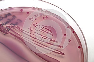 E. coli on MacConkey agar photo