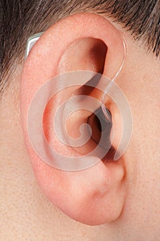 Ear with acoustic instrument