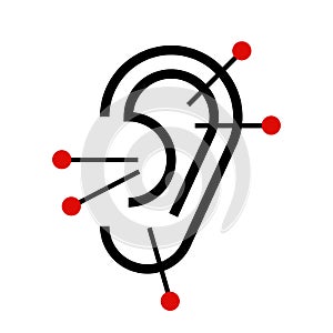 Ear acupuncture