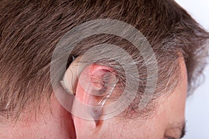 Ear and hearing aid