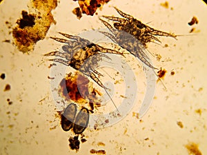 Ear mite from a cat, under the microscope