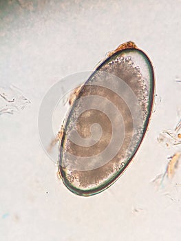 Ear mite egg from a cat, under the microscope