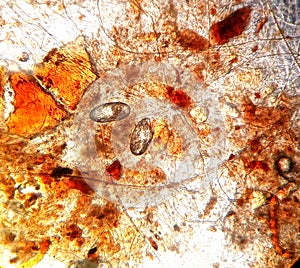 Ear mite eggs under the microscope