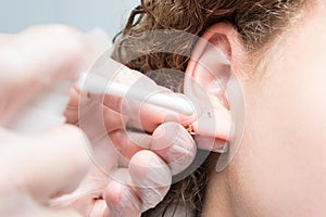 Ear piercing treatment for decoration, close-up