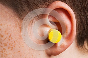 Earplug