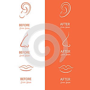 Ears, nose and lips reshaping before and after surgery.