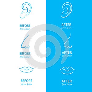 Ears, nose and lips reshaping before and after surgery.