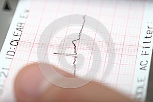 Zemetrasenie na seizmograf 