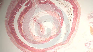 Earthworm cross-section