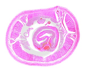 Earthworm under the microscope