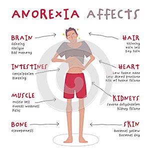 Eating disorder in men and boys. Anorexia nervosa. photo
