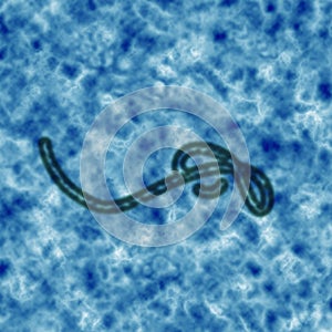 Ebola virus.