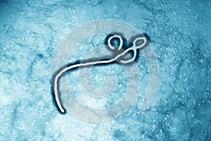 Ebola Virus photo