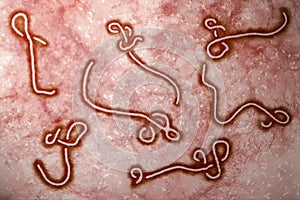 Ebola Virus photo